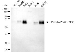 Western blotting analysis using Phospho-Paxillin (Y118) antibody (ABIN7799745).