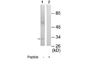 Image no. 1 for anti-MAX-Like Protein X (MLX) antibody (ABIN272258)