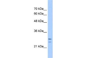 WB Suggested Anti-SRPRB Antibody Titration:  5. (SRPRB Antikörper  (C-Term))