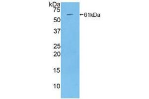 Western blot analysis of recombinant Rat THBS4. (THBS4 Antikörper  (AA 708-963))