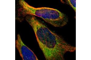 Immunofluorescent staining of human cell line U-2 OS with PFKM polyclonal antibody  under 1-4 ug/mL working concentration shows positivity in endoplasmic reticulum. (PFKM Antikörper)