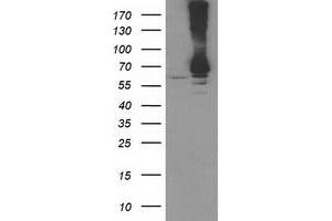 Western Blotting (WB) image for anti-Ribophorin 1 (RPN1) antibody (ABIN1500753) (RPN1 Antikörper)