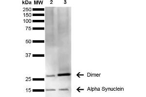 Western Blot analysis of Human Brain showing detection of 14 kDa Alpha Synuclein protein using Mouse Anti-Alpha Synuclein Monoclonal Antibody, Clone 3C11 (ABIN5564053). (SNCA Antikörper)