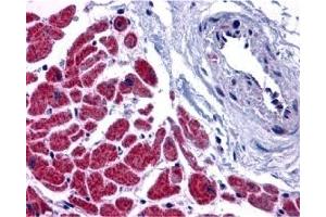 Immunohistochemistry (IHC) image for anti-Caspase 12 (Gene/pseudogene) (CASP12) (N-Term) antibody (ABIN1031295) (Caspase 12 Antikörper  (N-Term))