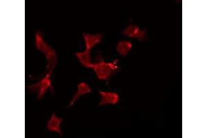 ABIN6272668 staining Hela by IF/ICC. (BCMA Antikörper  (Internal Region))