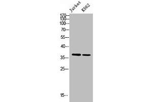Western blot analysis of JK K562 using NHERF-2 antibody. (SLC9A3R2 Antikörper  (N-Term))