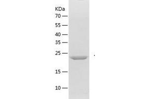 FGF20 Protein (AA 3-211) (His tag)