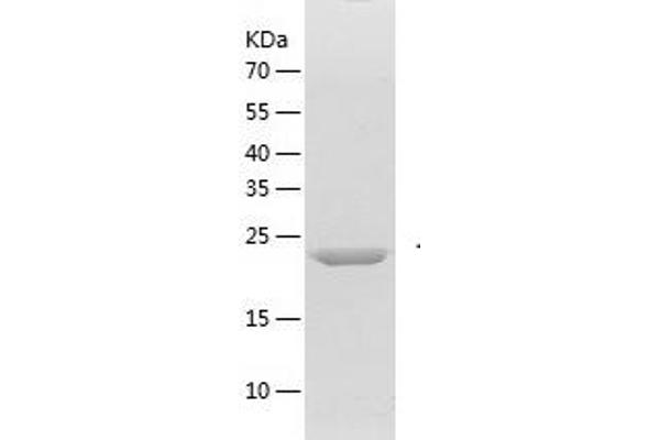 FGF20 Protein (AA 3-211) (His tag)