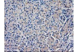 Immunohistochemical staining of paraffin-embedded Human pancreas tissue using anti-GUK1 mouse monoclonal antibody. (GUK1 Antikörper)
