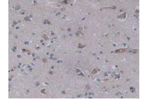 IHC-P analysis of Human Brain Tissue, with DAB staining. (JAG2 Antikörper  (AA 714-981))