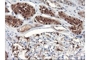 Immunohistochemical staining of paraffin-embedded Human Kidney tissue using anti-FBXO21 mouse monoclonal antibody. (FBXO21 Antikörper)