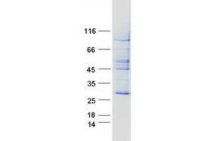 Western Blotting (WB) image for Der1-Like Domain Family, Member 2 (DERL2) protein (Myc-DYKDDDDK Tag) (ABIN2719402)