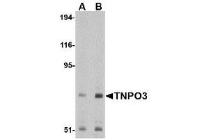 Image no. 1 for anti-Transportin 3 (TNPO3) (N-Term) antibody (ABIN1494359) (Transportin 3 Antikörper  (N-Term))