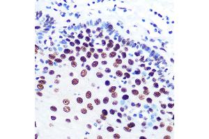 Immunohistochemistry of paraffin-embedded human esophageal using DDX5 Rabbit mAb (ABIN7266698) at dilution of 1:100 (40x lens). (DDX5 Antikörper)