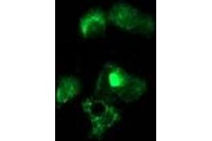 Anti-NUDT6 mouse monoclonal antibody (ABIN2454163) immunofluorescent staining of COS7 cells transiently transfected by pCMV6-ENTRY NUDT6 (RC203470).