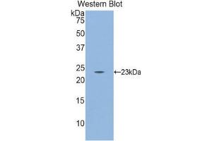 Western Blotting (WB) image for anti-CD8b Molecule (CD8B) (AA 21-208) antibody (ABIN1858317) (CD8B Antikörper  (AA 21-208))