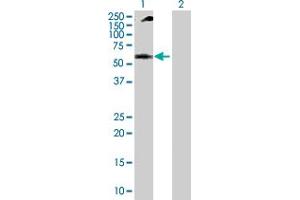 Western Blot analysis of NUP62 expression in transfected 293T cell line by NUP62 MaxPab polyclonal antibody. (NUP62 Antikörper  (AA 1-522))