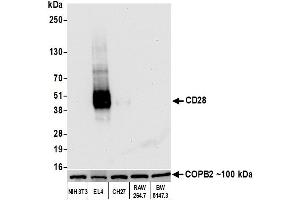 Western Blotting (WB) image for anti-CD28 (CD28) (AA 170-220) antibody (ABIN7455122) (Rekombinanter CD28 Antikörper  (AA 170-220))