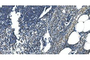 IHC analysis of LSM7 using anti-LSM7 antibody (ABIN7598937).