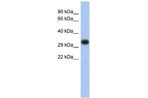 HLA-DPA1 antibody used at 1 ug/ml to detect target protein.