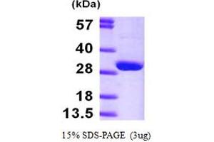 SDS-PAGE (SDS) image for Hypoxanthine phosphoribosyltransferase 1 (HPRT1) (AA 1-218) protein (His tag) (ABIN667016)