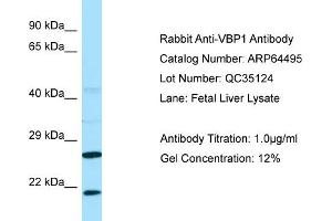 Western Blotting (WB) image for anti-Prefoldin Subunit 3 (PFDN3) (C-Term) antibody (ABIN2789852) (VBP1 Antikörper  (C-Term))
