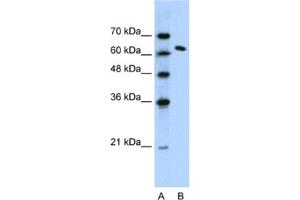 Western Blotting (WB) image for anti-FACT complex subunit SPT16 (SUPT16H) antibody (ABIN2460242) (SUPT16H Antikörper)