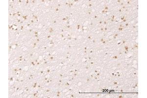 Immunostaining (ISt) image for anti-Mdm2, p53 E3 Ubiquitin Protein Ligase Homolog (Mouse) (MDM2) (AA 101-200) antibody (ABIN517806)