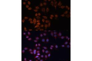 Immunofluorescence analysis of HeLa cells using  Polyclonal Antibody (ABIN6131157, ABIN6136523, ABIN6136524 and ABIN6223703) at dilution of 1:100 (40x lens). (ADAM15 Antikörper)