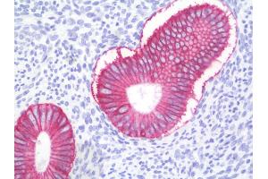 Anti-ESA / EPCAM antibody IHC staining of human uterus, endometrium. (EpCAM Antikörper)