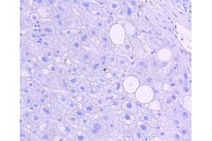 Immunohistochemistry of paraffin-embedded human liver using Phospho-JNK1/2/3-T183/T183/T221 antibody (abx125450) at dilution of 1/100 (40x lens).