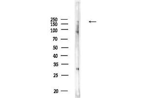 Western blot analysis of lysates from HUVEC cells, using CR1 Antibody at 1/1000 dilution.