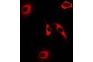 Immunofluorescent analysis of HNMT staining in U2OS cells.
