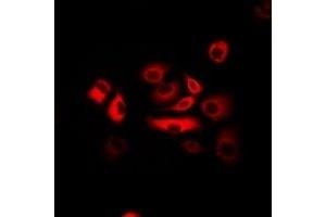 Immunofluorescent analysis of ATR staining in Hela cells. (ATR Antikörper)