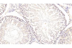 Immunohistochemistry (IHC) image for anti-Matrix Metallopeptidase 1 (Interstitial Collagenase) (MMP1) (AA 169-464) antibody (ABIN7430966)