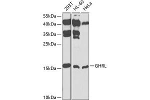 Western blot analysis of extracts of various cell lines, using GHRL antibody (ABIN3021900, ABIN3021901, ABIN3021902 and ABIN6217352) at 1:1000 dilution. (Ghrelin Antikörper  (AA 1-117))