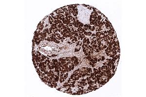 pancreas (CPA1 Antikörper)