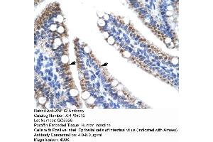 Human Intestine (ZNF12 Antikörper  (N-Term))