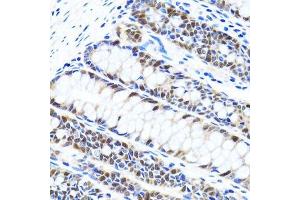 Immunohistochemistry of paraffin-embedded human colon using UHRF1 antibody.