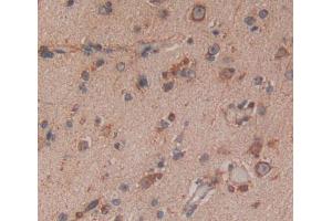 Used in DAB staining on fromalin fixed paraffin- embedded Kidney tissue (IRF8 Antikörper  (AA 128-426))