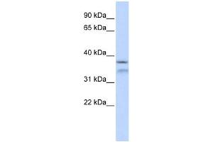 HYLS1 antibody used at 1 ug/ml to detect target protein.
