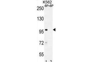 Western Blotting (WB) image for anti-IQ Motif Containing with AAA Domain 1 (IQCA1) antibody (ABIN2996486) (IQCA1 Antikörper)