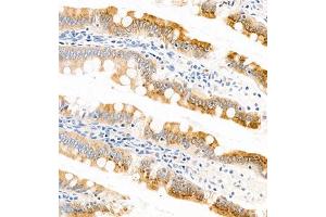 Immunohistochemistry of paraffin embedded rat small intestine using APOA4 (ABIN7073084) at dilution of 1:1200 (300x lens) (APOA4 Antikörper)