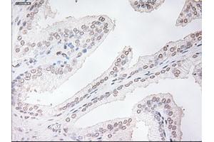 Immunohistochemical staining of paraffin-embedded prostate tissue using anti-TNNI3mouse monoclonal antibody. (TNNI3 Antikörper  (AA 1-210))