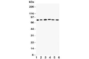 Western blot testing of Proprotein Convertase 1/3 antibody (Proprotein Convertase 1/3 (C-Term) Antikörper)