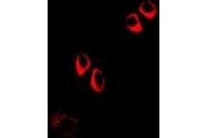 Immunofluorescent analysis of COQ3 staining in A549 cells. (COQ3 Antikörper)