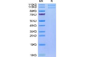 Human ITGA2&ITGB1 on Tris-Bis PAGE under reduced condition. (Integrin alpha 2 beta 1 (ITGA2 & ITGB1) Heterodimer (AA 30-1132) protein (His tag))