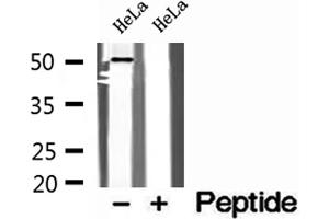 Western blot analysis of extracts of HeLa cells, using SNX17 antibody. (SNX17 Antikörper  (N-Term))
