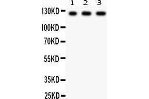 Anti-PLD1 Picoband antibody, Western blotting All lanes: Anti PLD1  at 0. (PLD1 Antikörper  (AA 1-330))