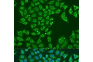 Immunofluorescence analysis of U2OS cells using ALDH1B1 Polyclonal Antibody at dilution of 1:100. (ALDH1B1 Antikörper)